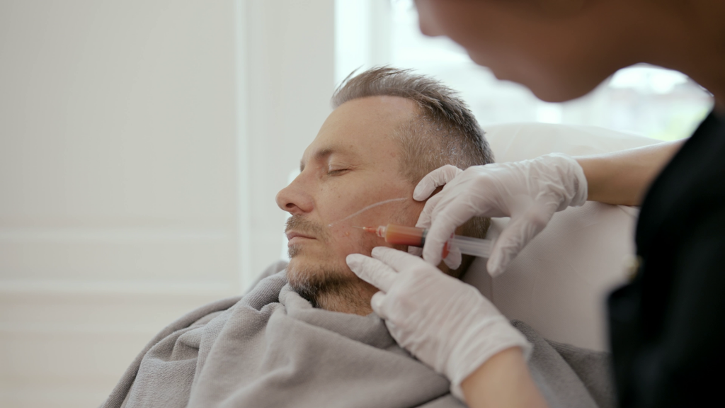 Mand får lavet behandling af hårtab i sit skæg med PRP