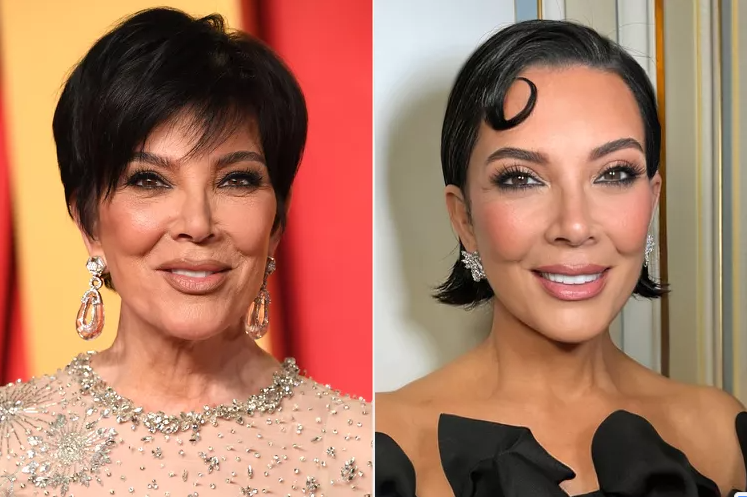 Kris Jenner ansigtsløft Kris Jenner ansigtsløft